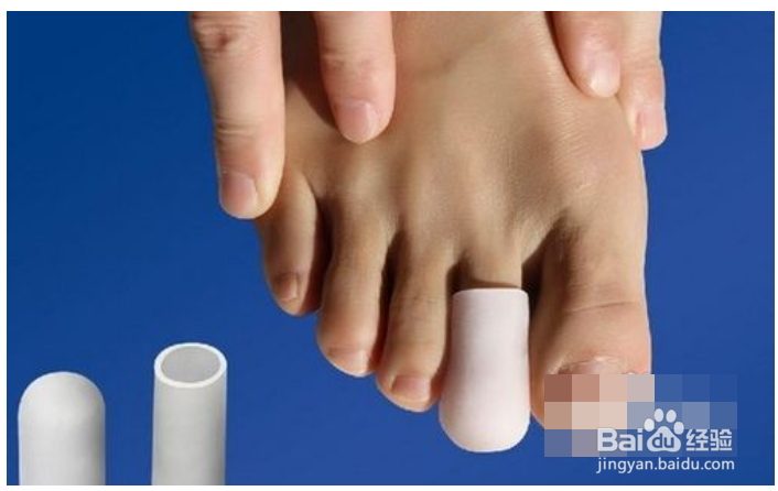 脚趾甲发白|是怎么回事|要怎么办