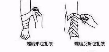 户外受伤如何正确地处理包扎