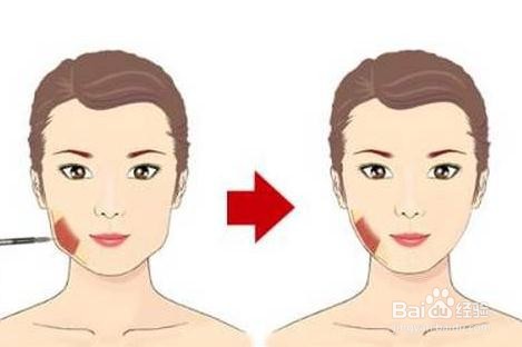 婴儿肥怎么瘦脸 婴儿肥怎么瘦脸简单最快方法