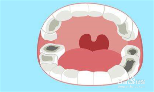 长了虫牙日常要注意些什么