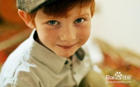 学生如何祛斑/青少年去雀斑方法