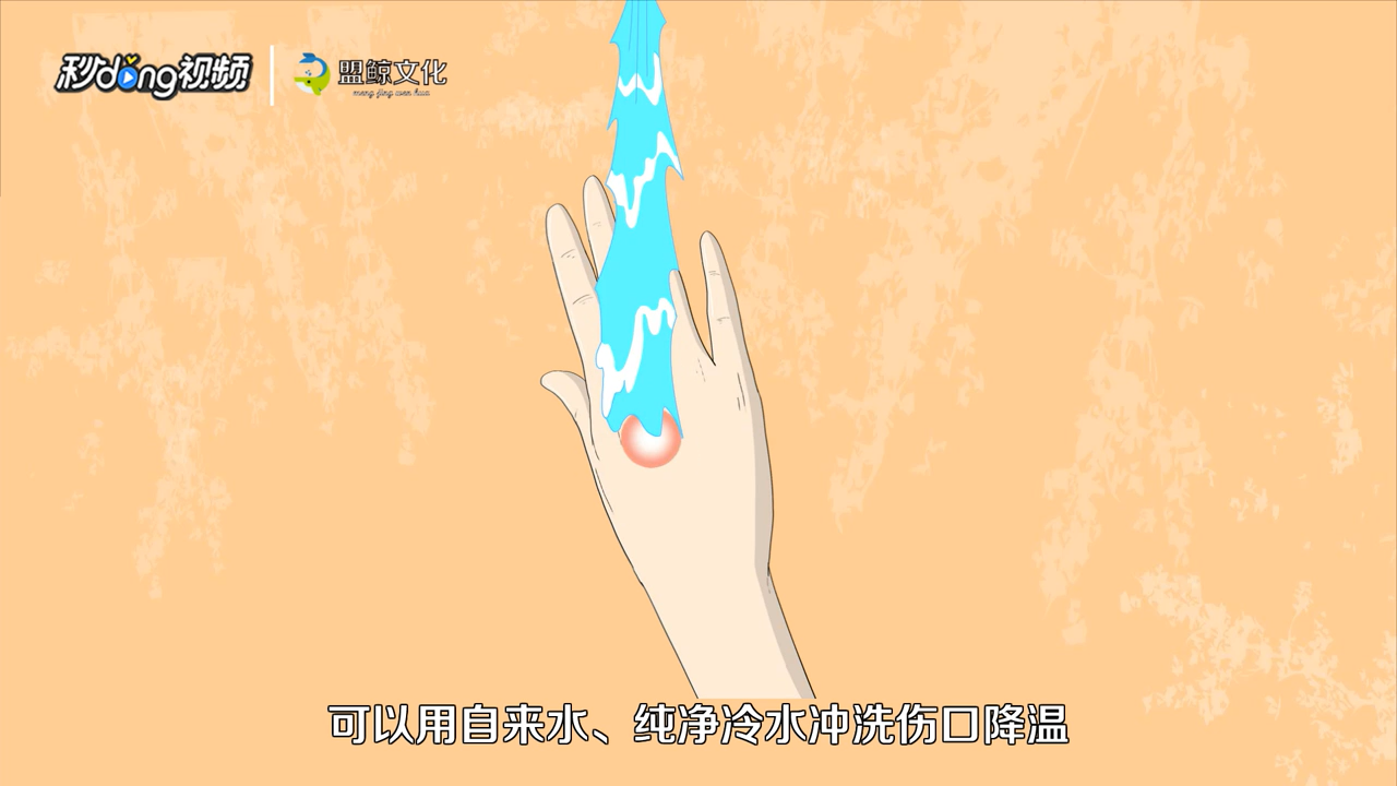 烫伤怎么处理