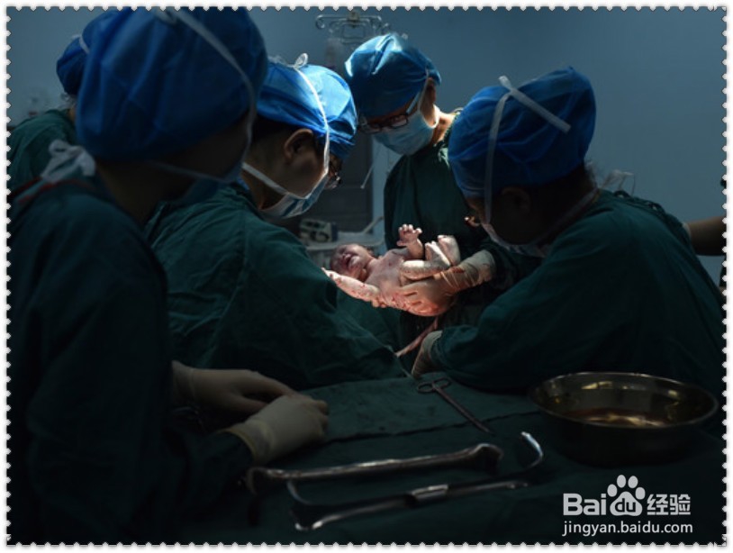 如何预防母婴传播疾病