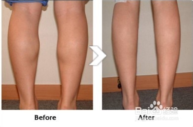 如何快速瘦小腿