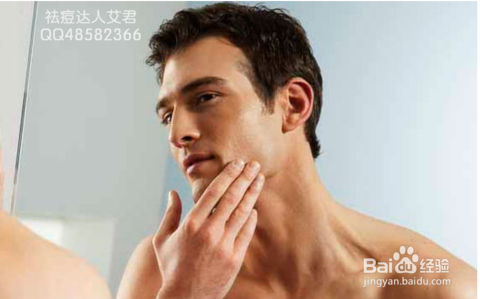 男士脸上各部位长痘痘的原因