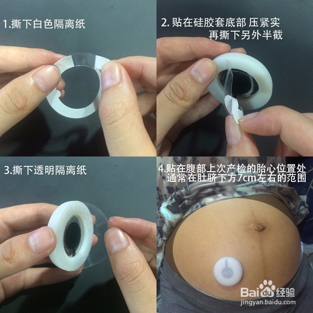 怎样及时发现胎儿缺氧