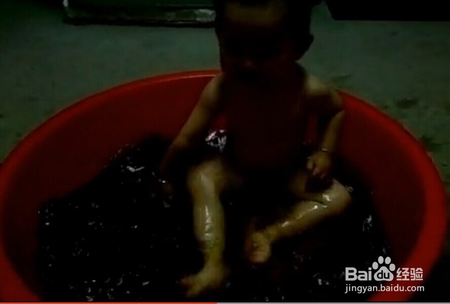 顽固湿疹我来支招