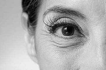 怎样消除眼角皱纹