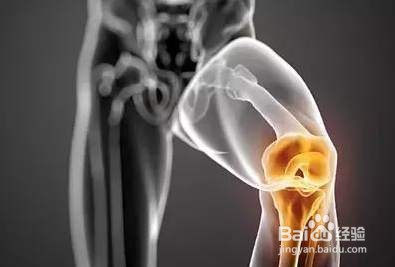 半月板损伤的症状