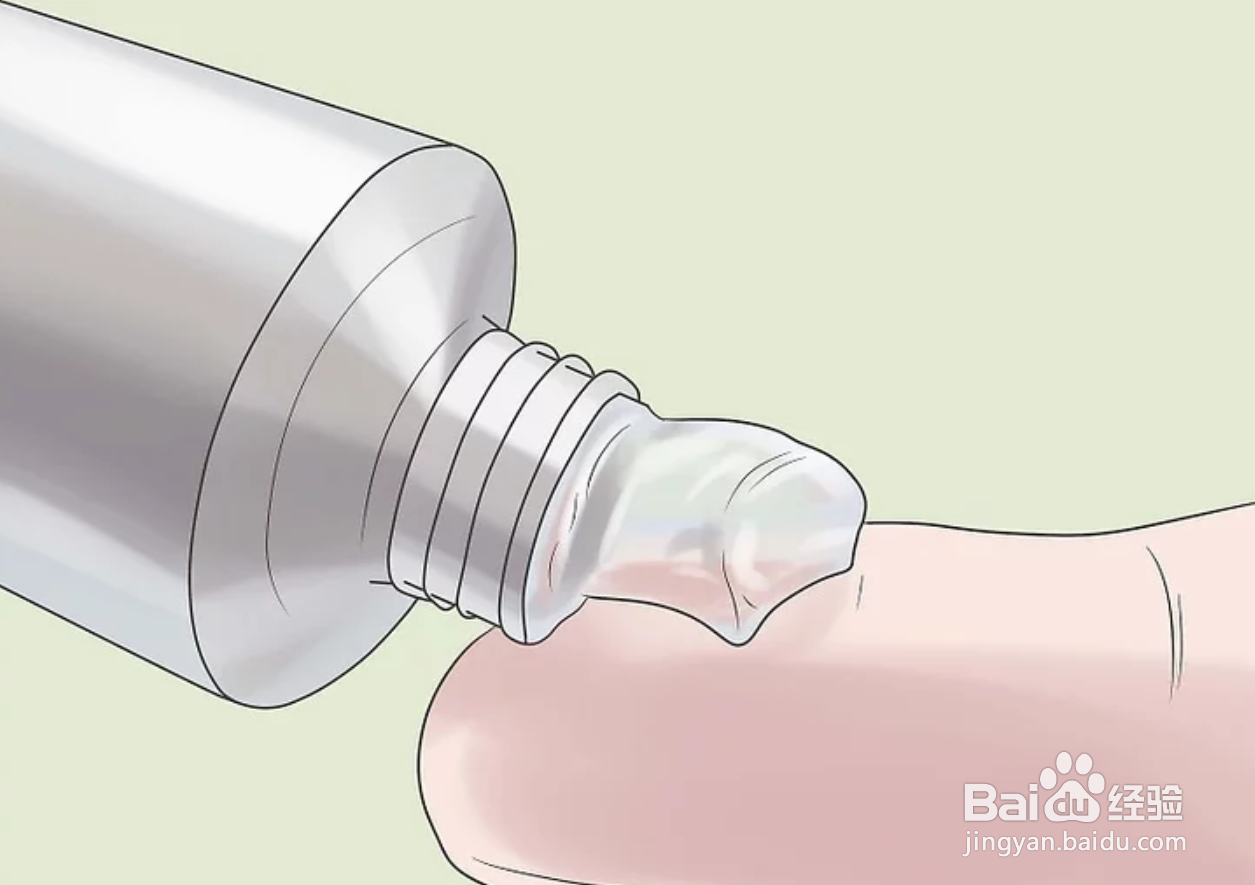 如何治疗新生儿便秘