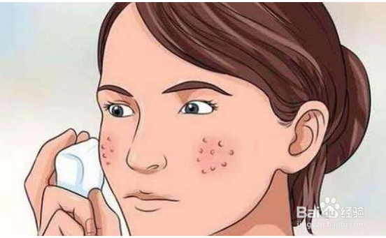 毛孔收缩方法有哪些