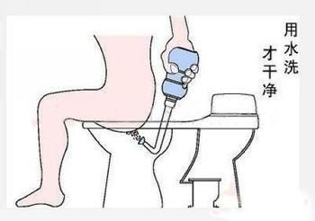 痔疮要怎么预防