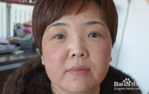 如何调理身体湿寒？湿寒重的症状