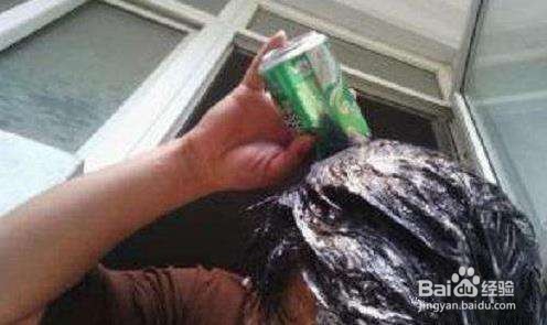 头皮屑怎么祛除