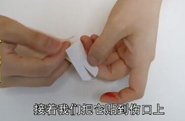 怎样在贴创口贴后手指可以自由活动