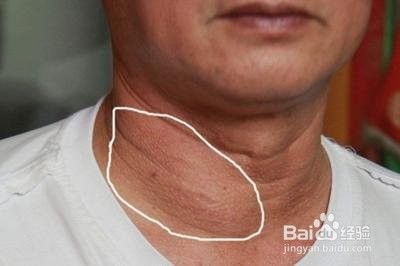 脖子粗怎么减 百度经验