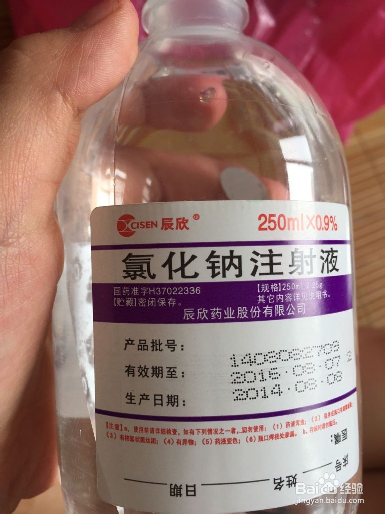 如何使埋线双眼皮快速消肿