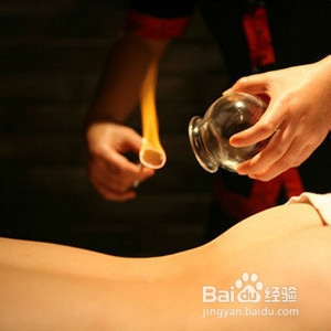 拔火罐,你了解多少?