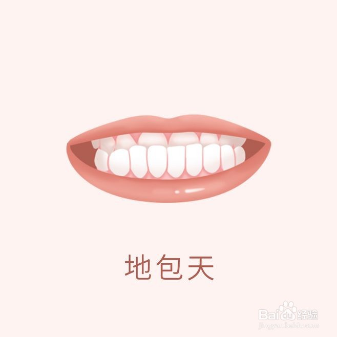 牙齿矫正类型