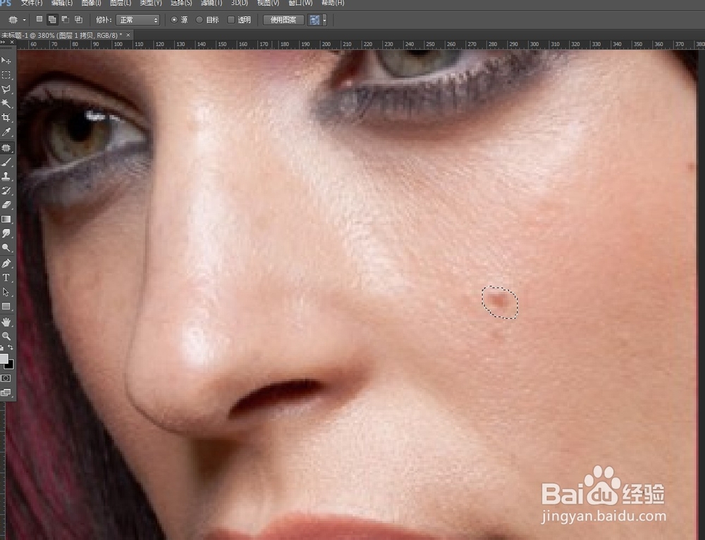 用ps污点修复画笔工具去掉脸上的痘痘