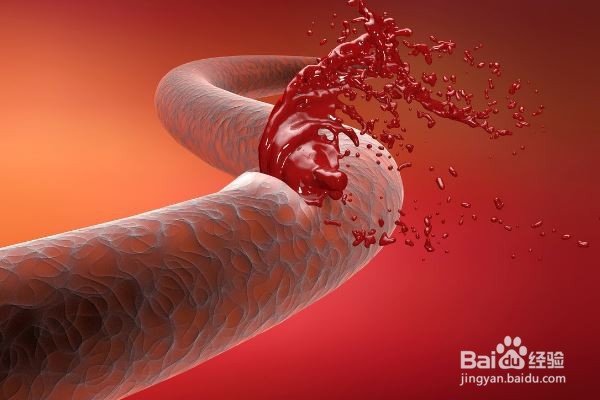 血脂异常有哪些危害