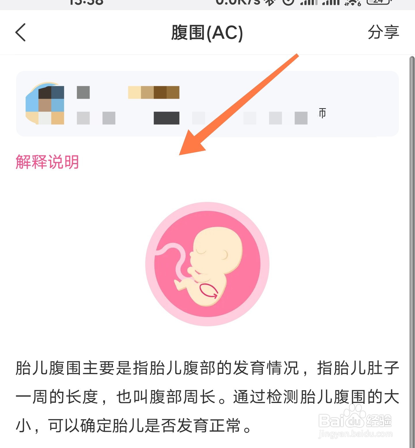 美柚如何解读B超单