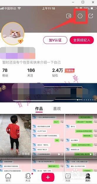 全民小视频怎么联系客服 全民怎么反馈问题