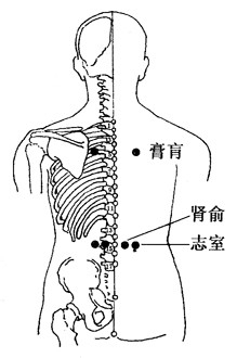 百病拔罐：[17]健忘的拔罐疗法