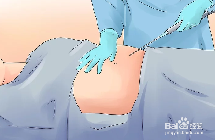 如何减肥最快不反弹