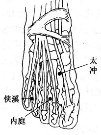 百病刮痧：[44]带状疱疹的刮痧疗法