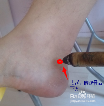 艾灸治疗过敏性鼻炎
