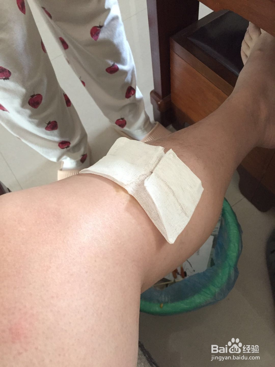 身体出现物品划伤如何处理