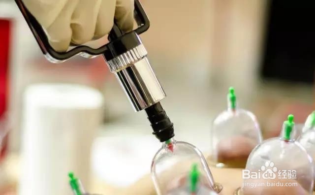 拔火罐的常见误区