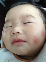 蚊子为什么总咬你？