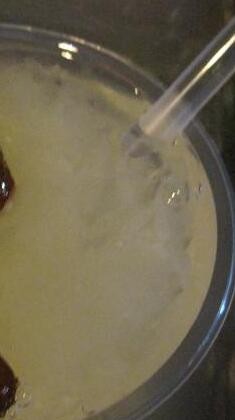 使用偏方后子宫肌瘤消失