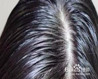 需要养肝的10个信号