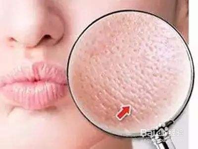 毛孔堵塞怎么疏通 毛孔堵塞疏通小窍门