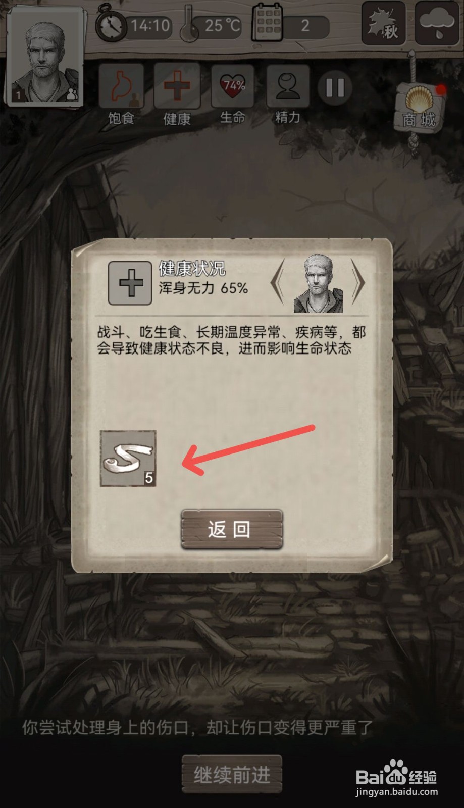 荒野日记怎么在游戏里处理伤口