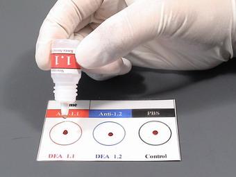 孕早期准妈妈需做的常规检查