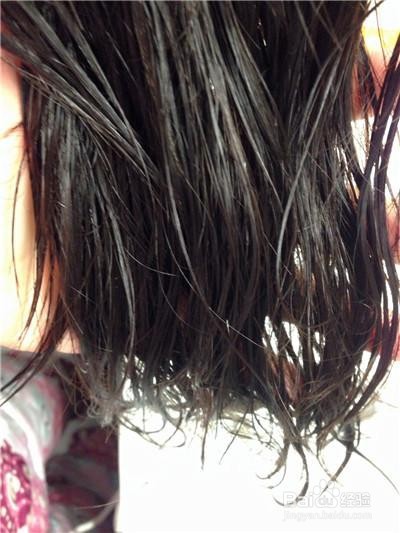 #头旋处头发稀少怎么办#