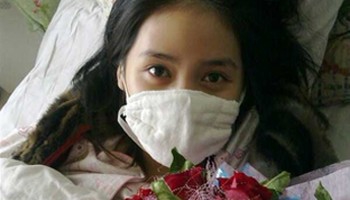 淋巴癌的早期症状是什么
