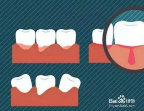 茶叶包在日常生活中有什么奇妙的用处？