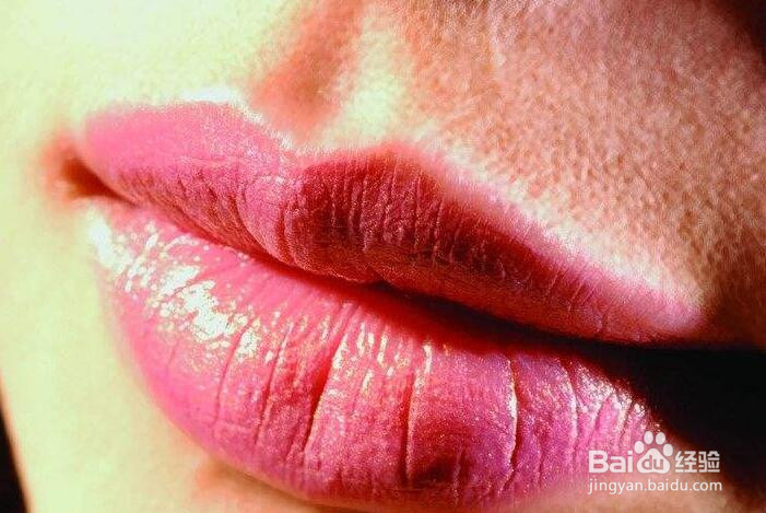 擦口红嘴唇起皮怎么办