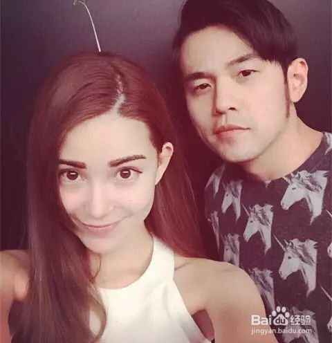 昆凌产后同样脱发，新妈妈发际线后移该咋办？