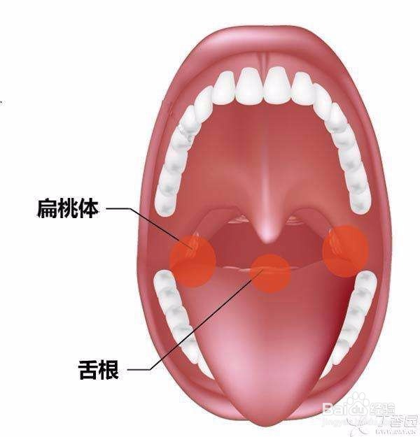医学考试中咽部以及扁桃体的检查