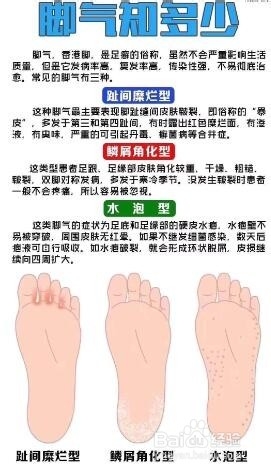 怎样识别不同类型的脚气