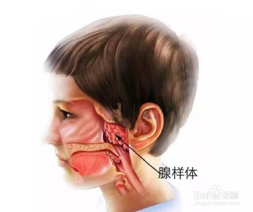 儿童腺样体肥大的表现形式与病因