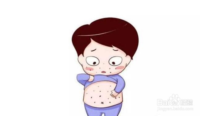 打破伤风一周后过敏怎么办？