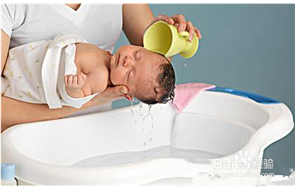 新生儿护理不可忽略的几个问题