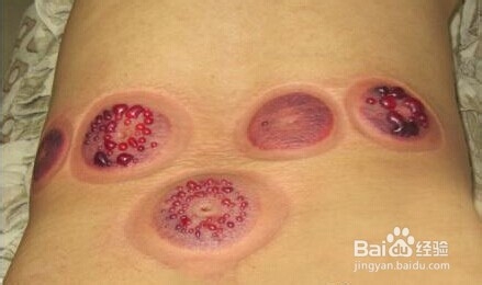 女性的普遍问题：宫寒